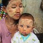 Myanmar - Mother and Child